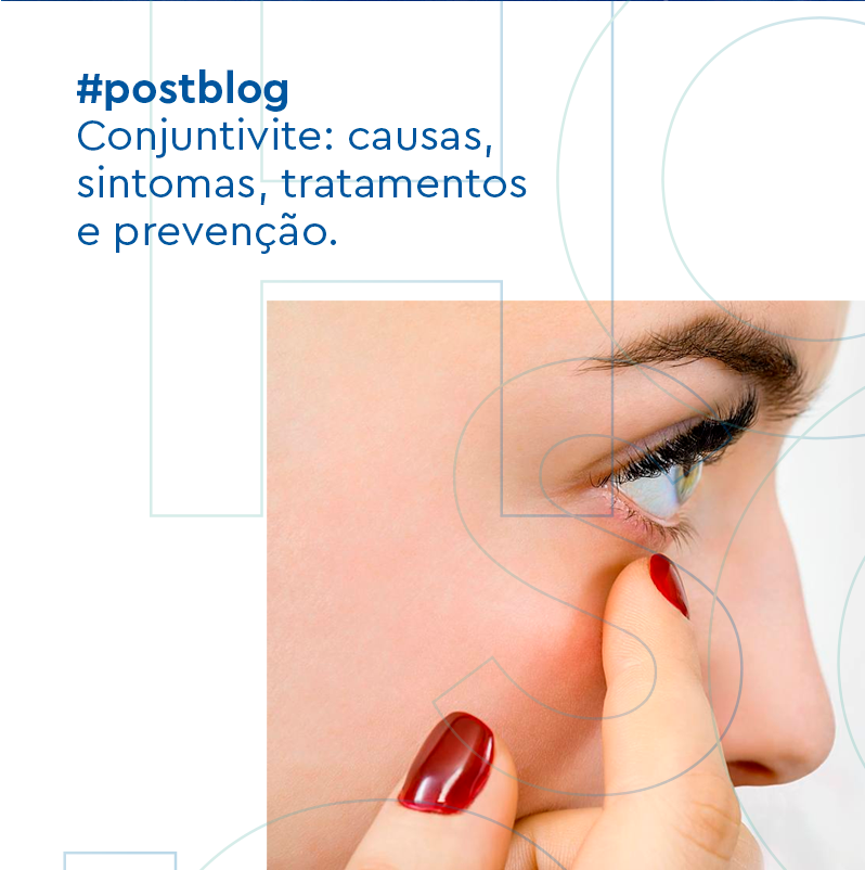 Conjuntivite causas, sintomas, tratamento e prevenção Hospital de