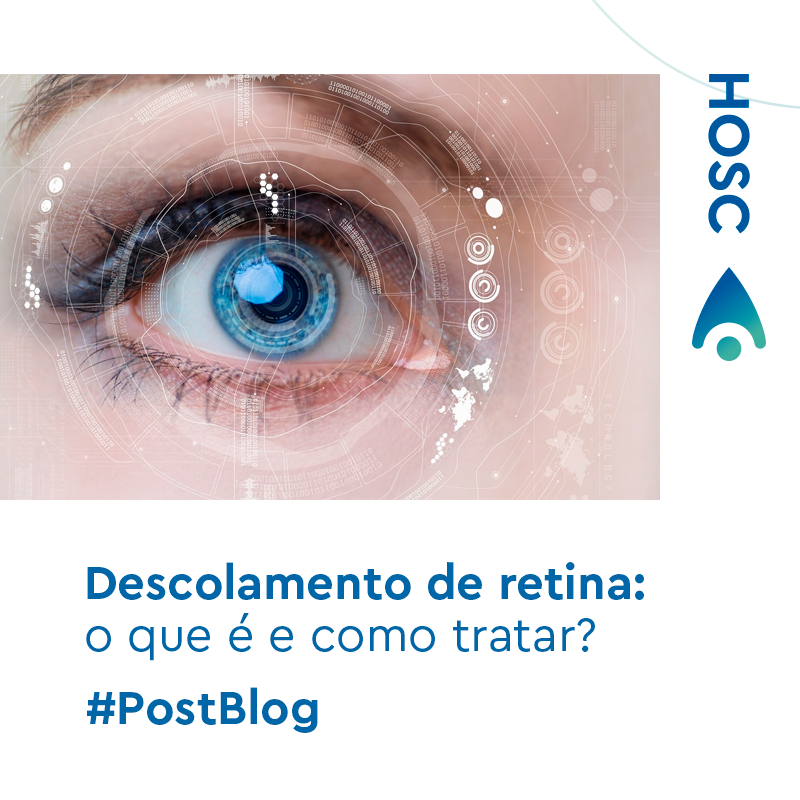 diabetes de deslocamento de retina diabetes de deslocamento de retina