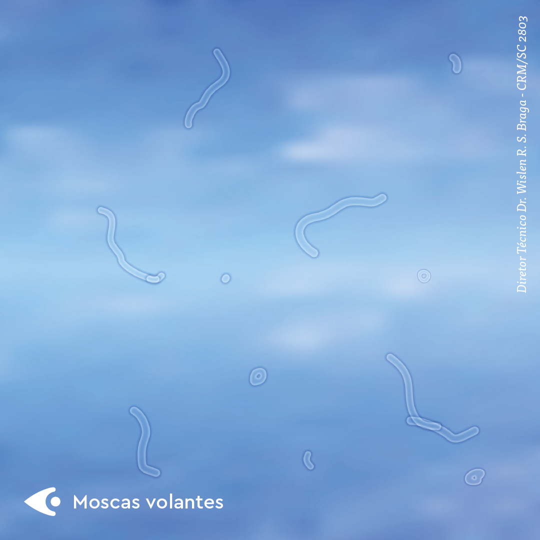 Moscas volantes: o que são, como surgem e como tratar. – Hospital de ...