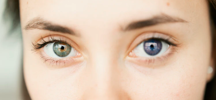 Terçol no Olho: Causas, Sintomas, Autocuidados e Tratamento